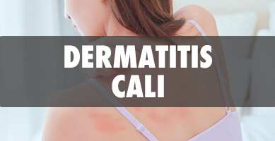 Dermatitis en Cali - Salud y Estética TV