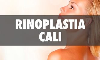 Rinoplastia en Cali - Salud y Estética TV
